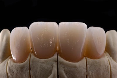 Precision Root Canals in Las Vegas, NV